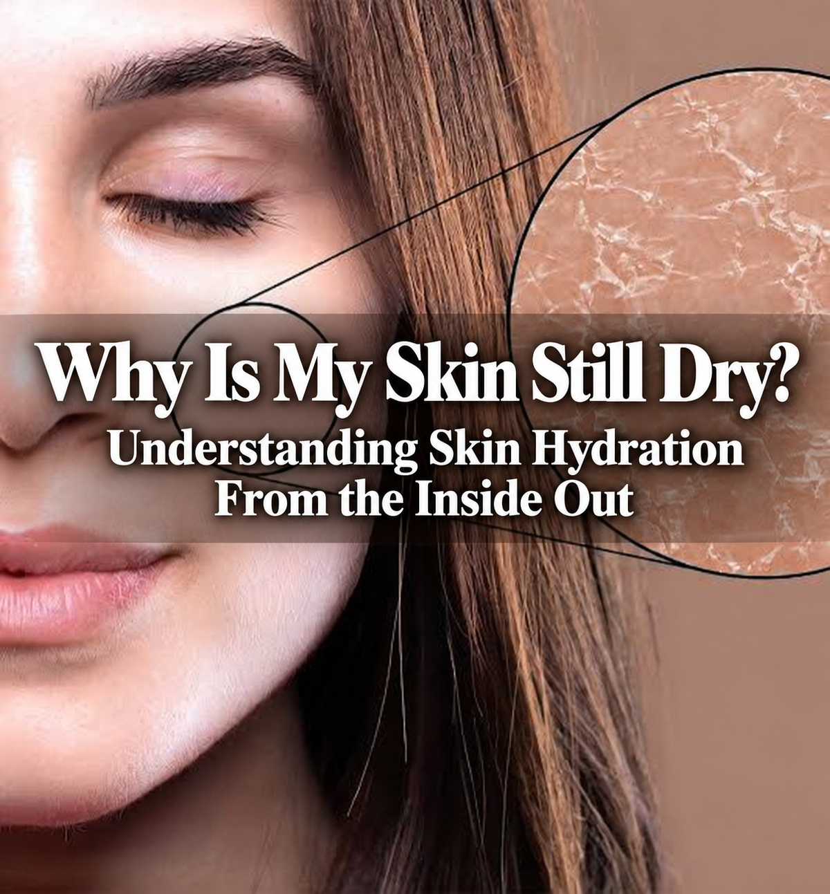 Why Is My Skin Still Dry? Understanding Skin Hydration From the Inside Out